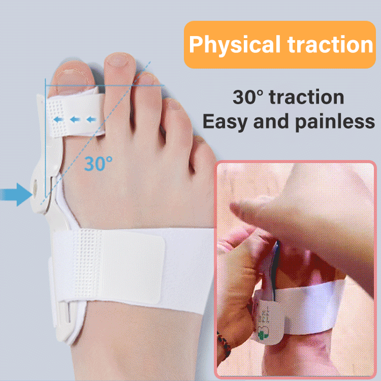 ✅【Sada 2 ks】🌿👍Korektor Ballux, ideální pro korekci hallux valgus, kladívkového prstu a palce na noze! (Vhodné pro tělesnou hmotnost mezi 40 a 80 kg)
