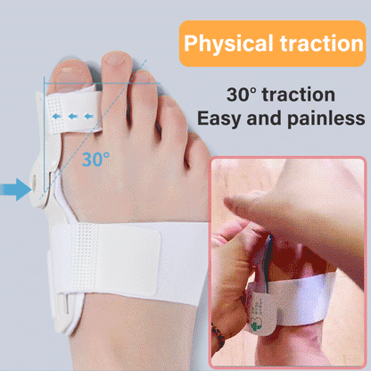 ✅【Sada 2 ks】🌿👍Korektor Ballux, ideální pro korekci hallux valgus, kladívkového prstu a palce na noze! (Vhodné pro tělesnou hmotnost mezi 40 a 80 kg)